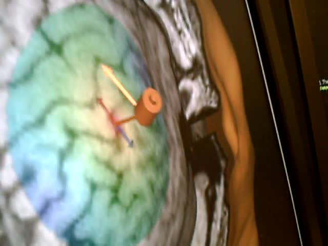 video 4